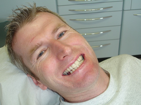 Mark had Zoom teeth whitening